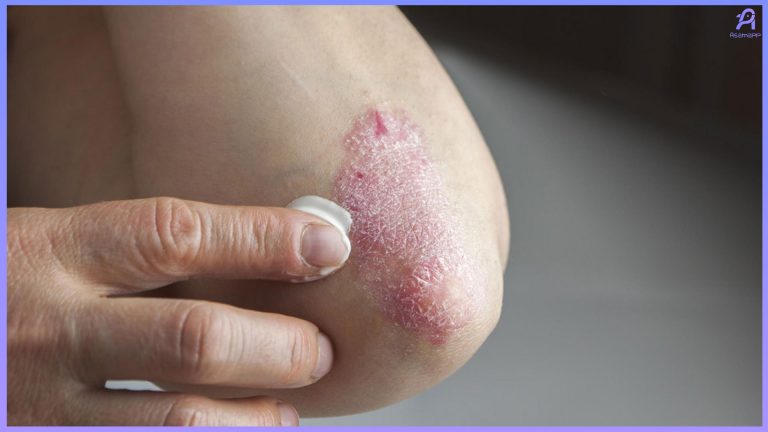 تفاوت اگزما و خشکی پوست در چیست؟